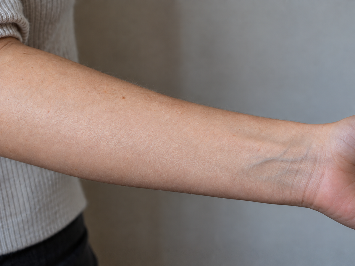 AI illustration of the same inner forearm after the thin script tattoo is removed and the skin rebuilt