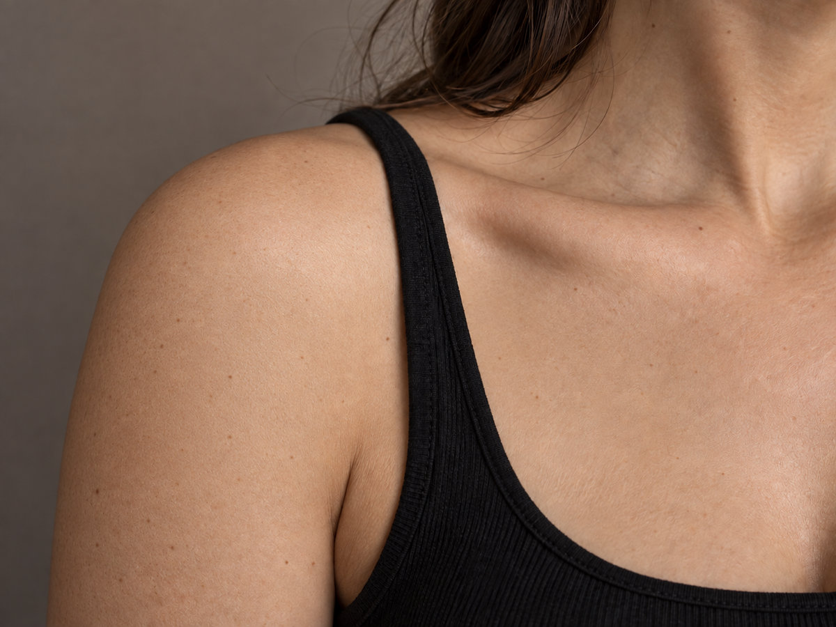 AI illustration of the same shoulder after the shaded tattoo is removed and the shoulder skin rebuilt